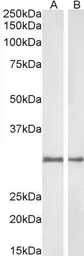 Anti-NQO1 antibody, C-term used in Western Blot (WB). GTX89937