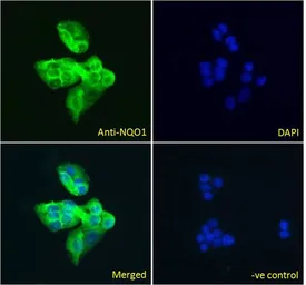 Anti-NQO1 antibody, C-term used in Immunocytochemistry/ Immunofluorescence (ICC/IF). GTX89937