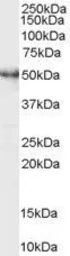 Anti-MST4 antibody, C-term used in Western Blot (WB). GTX89947
