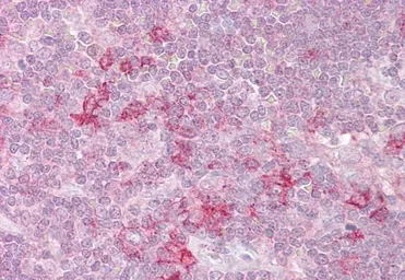 Anti-MST4 antibody, C-term used in IHC (Paraffin sections) (IHC-P). GTX89947