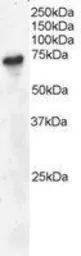 Anti-BLNK antibody, C-term used in Western Blot (WB). GTX89949