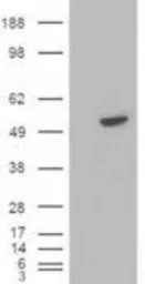 Anti-BLNK antibody, C-term used in Western Blot (WB). GTX89949