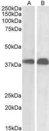Anti-SET antibody, N-term used in Western Blot (WB). GTX89960