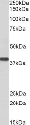Anti-SET antibody, N-term used in Western Blot (WB). GTX89960