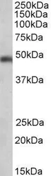 Anti-SEC61A1 antibody, C-term used in Western Blot (WB). GTX89964