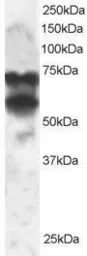 Anti-PPP2R5D antibody, C-term used in Western Blot (WB). GTX89966