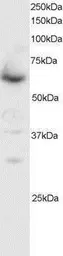 Anti-SMAD4 antibody, C-term used in Western Blot (WB). GTX89968