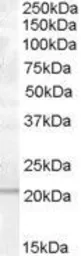 Anti-PTP4A1 antibody, C-term used in Western Blot (WB). GTX89969