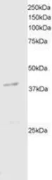 Anti-DAP Kinase 2 antibody, C-term used in Western Blot (WB). GTX89970