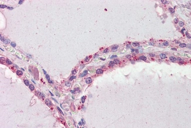 Anti-DAP Kinase 2 antibody, C-term used in IHC (Paraffin sections) (IHC-P). GTX89970