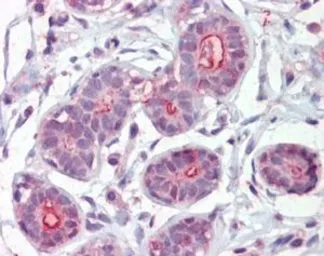 Anti-DAP Kinase 2 antibody, C-term used in IHC (Paraffin sections) (IHC-P). GTX89970