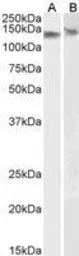 Anti-DDB1 antibody, C-term used in Western Blot (WB). GTX89975