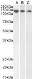 Anti-DDB1 antibody, C-term used in Western Blot (WB). GTX89975