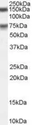 Anti-MELK antibody, C-term used in Western Blot (WB). GTX89981