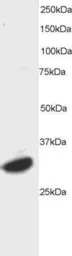 Anti-ATF7 antibody, C-term used in Western Blot (WB). GTX89982