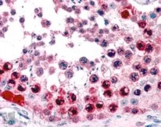 Anti-ATF7 antibody, C-term used in IHC (Paraffin sections) (IHC-P). GTX89982