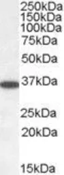 Anti-PP2A alpha + PP2A beta antibody, C-term used in Western Blot (WB). GTX89984