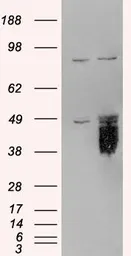 Anti-TFPI antibody, C-term used in Western Blot (WB). GTX89985