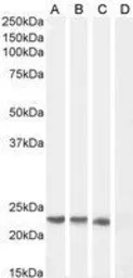 Anti-SOCS1 antibody, C-term used in Western Blot (WB). GTX89995