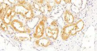Anti-SOCS1 antibody, C-term used in IHC (Paraffin sections) (IHC-P). GTX89995