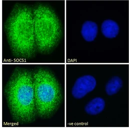 Anti-SOCS1 antibody, C-term used in Immunocytochemistry/ Immunofluorescence (ICC/IF). GTX89995