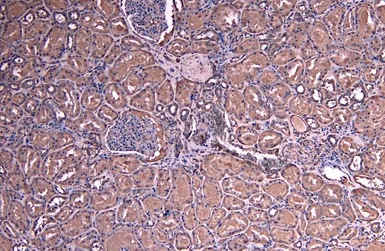 Anti-SOCS1 antibody, C-term used in IHC (Paraffin sections) (IHC-P). GTX89995
