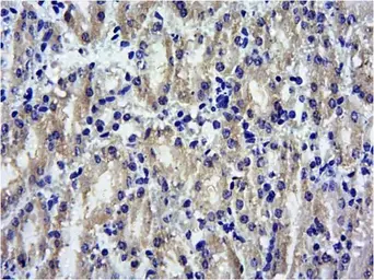 Anti-SOCS1 antibody, C-term used in IHC (Paraffin sections) (IHC-P). GTX89995