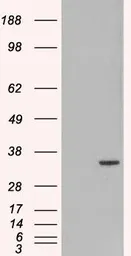 Anti-ORC6 antibody, C-term used in Western Blot (WB). GTX89996