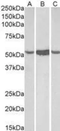 Anti-ALDH1A1 antibody, C-term used in Western Blot (WB). GTX90658