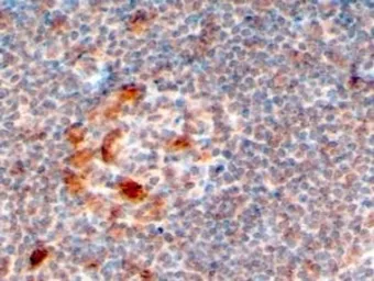 Anti-ZCCHC11 antibody, C-term used in IHC (Paraffin sections) (IHC-P). GTX94119