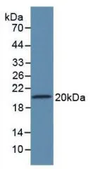 WB analysis of GTX00062-pro Rat SLIT2 protein.