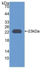 WB analysis of GTX00064-pro Rat TIMP3 protein (active).