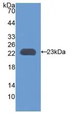 WB analysis of GTX00064-pro Rat TIMP3 protein. WB analysis of GTX00064-pro Rat TIMP3 protein.