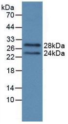 WB analysis of GTX00069-pro Human Prolactin protein (active).