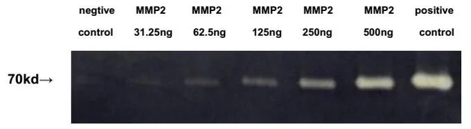 Gelatin hydrolysis by various concentrations of GTX00073-pro Mouse MMP2 protein (active). Positive control: Blood sample Negative control: Heat-denatured MMP2 protein