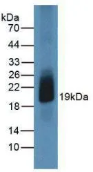 WB analysis of GTX00082-pro Human GM-CSF protein (active).