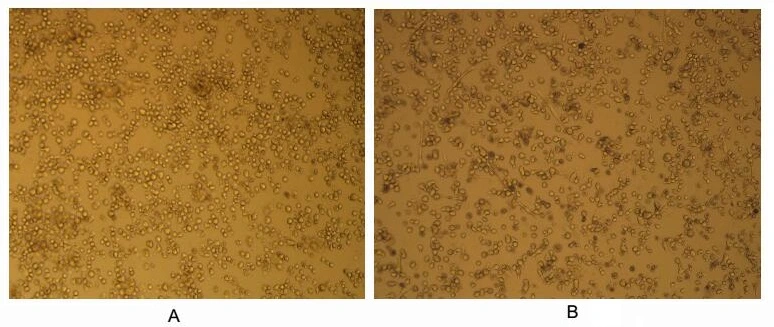 Cell differentiation effect of GTX00082-pro Human GM-CSF protein (active).<br>(A) Unstimulated U937 cells cultured in RPMI-1640.<br>(B) U937 cells cultured in RPMI-1640, stimulated with GM-CSF (10 ng/ml).