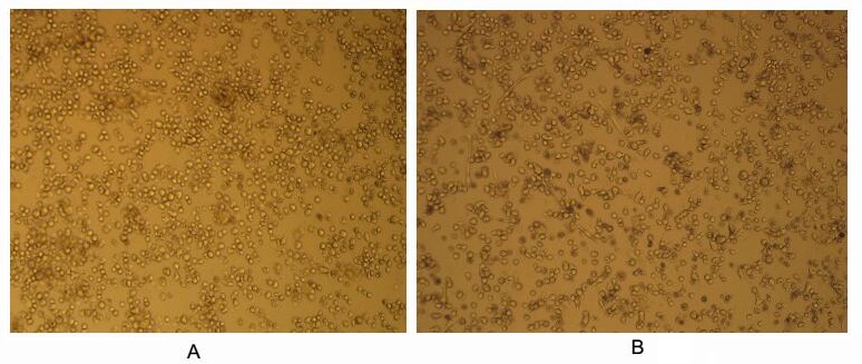 Cell differentiation effect of GTX00082-pro Human GM-CSF protein (active).<br>(A) Unstimulated U937 cells cultured in RPMI-1640.<br>(B) U937 cells cultured in RPMI-1640, stimulated with GM-CSF (10 ng/ml).