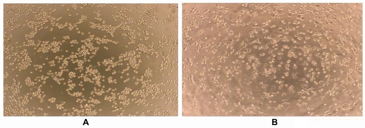Human Interferon Gamma Protein His Tag active GTX00084 pro GeneTex