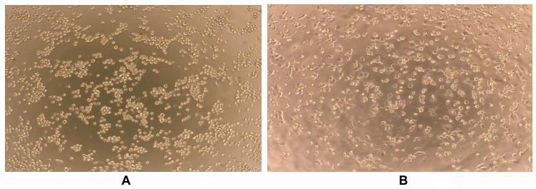 Activation effect of GTX00084-pro Human Interferon gamma protein (active).<br>(A) Unstimulated THP-1 cells cultured in RPMI-1640.<br>(B) THP-1 cells cultured in RPMI-1640, stimulated with 2 ng/ml IFN gamma for 5 days.