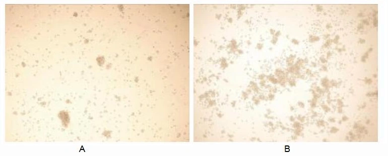 Cell proliferation effect of GTX00088-pro Human IL15 protein (active).<br>(A) Unstimulated Jurkat cells cultured in RPMI-1640 for 72hrs.<br>(B) Jurkat cells cultured in RPMI-1640, stimulated with 1 ng/ml IL15 for 72hrs.