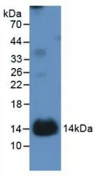 WB analysis of GTX00091-pro Human IL1 Receptor 1 protein. WB analysis of GTX00091-pro Human IL1 Receptor 1 protein.