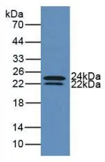 WB analysis of GTX00095-pro Human IL6 protein (active). WB analysis of GTX00095-pro Human IL6 protein (active).