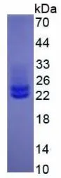 SDS-PAGE analysis of GTX00095-pro Human IL6 protein (active).