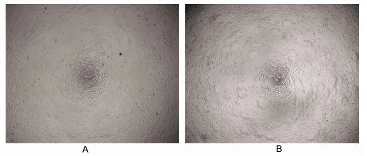 The inhibition effect of GTX00095-pro Human IL6 protein (active) on cell proliferation. (A) Unstimulated MCF-7 cells cultured in serum-free DMEM for 96hrs. (B) MCF-7 cells cultured in serum-free DMEM, stimulated with 100 ng/ml IL-6 for 96hrs.