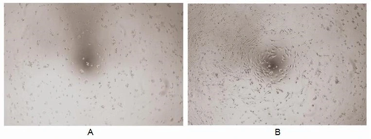 Cell proliferation effect of GTX00100-pro Human TGF alpha protein (active).<br>(A) Unstimulated 3T3 cells cultured in serum-free DMEM for 72hrs.<br>(B) 3T3 cells cultured in DMEM, stimulated with 1 ng/ml TGF alpha for 72hrs.