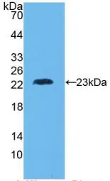 WB analysis of GTX00103-pro Human TNF beta protein (active). WB analysis of GTX00103-pro Human TNF beta protein (active).