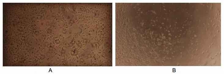 The apoptosis effect of GTX00103-pro Human TNF beta protein (active). (A) A549 cells cultured in DMEM for 72hrs. (B) A549 cells cultured in DMEM, stimulated with 10 ng/ml TNF-beta for 72hrs.