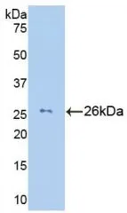 WB analysis of GTX00112-pro Human Granzyme M protein (active). WB analysis of GTX00112-pro Human Granzyme M protein (active).