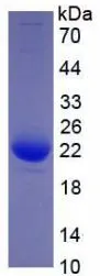 SDS-PAGE analysis of GTX00115-pro Human IL1 beta protein (active).